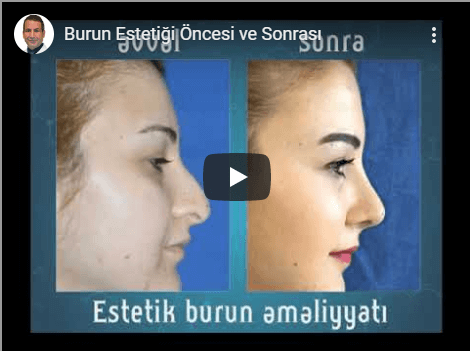 Burun Estetiği