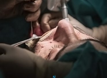 Kieferchirurgie