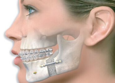 Orthognathie