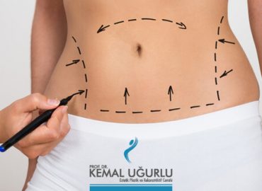 Vaser Liposuktion